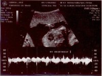 baby 19 weeks 4.jpg