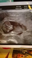 baby2scan.jpg