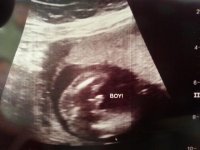 19 weeks, it's a BOY.jpg