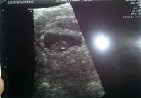 ultrasound.jpg