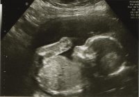 Baby 20 Weeks 04.jpg