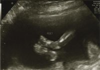 Baby 20 Weeks 02.jpg