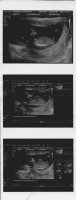 Baby312-weekscan.jpg