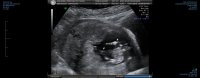 OBS NUCHAL 0002.jpg