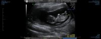 OBS NUCHAL 0005.jpg