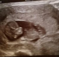 baby1scan.jpg