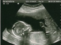 Baby 19w 5d 1st.jpg