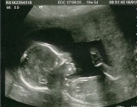 Baby 19w 5d 2nd.jpg