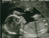 Baby 19w 5d 3rd.jpg