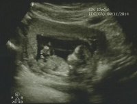 scan.jpg