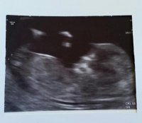 12week scan.jpg