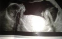 ultrasound.jpg