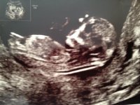 baby #8 2.jpg