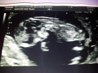 baby 06.02.2014.jpg