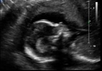 20 week ultrasound.jpg