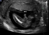 20 week ultrasound boy.jpg