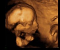 BABY_12.jpg