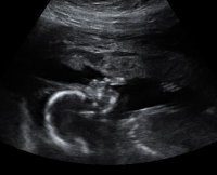 BABY_32.jpg