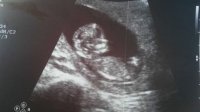 Baby #3 - 12 weeks.jpg