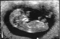 10w5d cropped.jpg