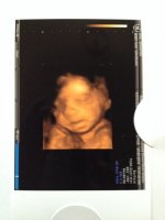 Baby pip 25 weeks 6 days.jpg