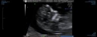 Ultrasound 1.jpg