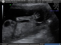 BABY_9.jpg