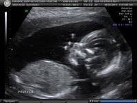 BABY_2.jpg