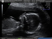 BABY_7.jpg