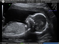 BABY_14.jpg