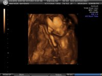 BABY_17.jpg