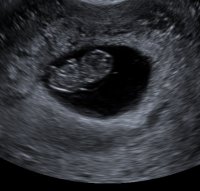 baby3.jpg