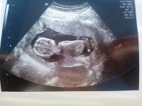 baby12w6d.jpg