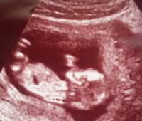 baby at 12 weeks(2).png