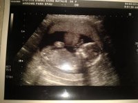 16 WEEK SCAN.jpg