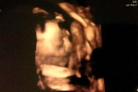 Ava 27 weeks_3D profile.jpg