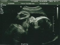 Baby4-33week (Small).jpg