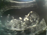 Ultrasound12w4d.jpg