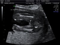 BABY 3_20.jpg