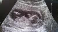 ultrasound1.jpg