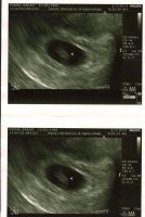 Ultrasound 7 weeks.jpg