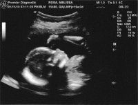 20 week ultrasound 3small.jpg