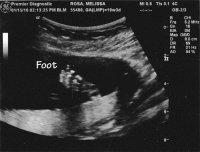 20 week ultrasound2 copy.jpg