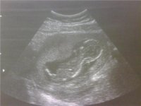 baby spine.jpg