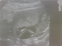 baby legs stretched.jpg