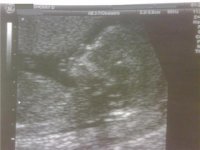 baby profile edit.jpg