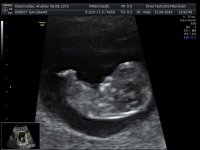 PÃ¼nktchen Profil 11.04.2014.jpg