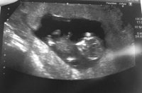 12 week scan3.jpg