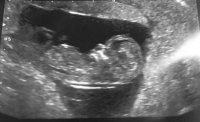 12 week scan1.jpg