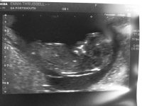 12 week scan2.jpg